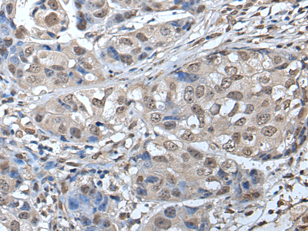 Rabbit Polyclonal Antibody to SMC1A