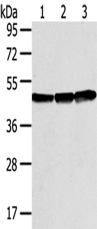 Rabbit Polyclonal Antibody to SMYD3