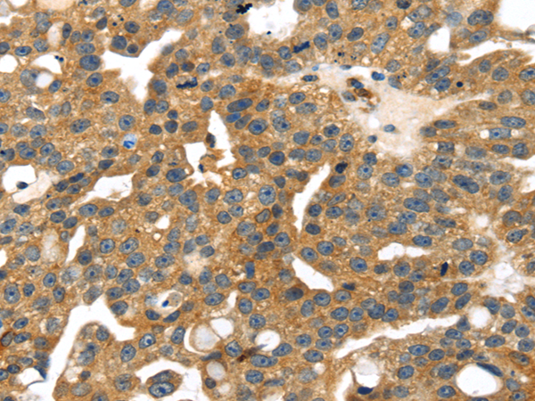 Rabbit Polyclonal Antibody to SMYD4