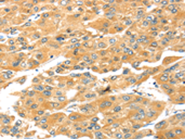 Rabbit Polyclonal Antibody to SNAI3
