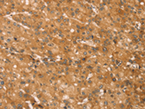 Rabbit Polyclonal Antibody to SNAP29