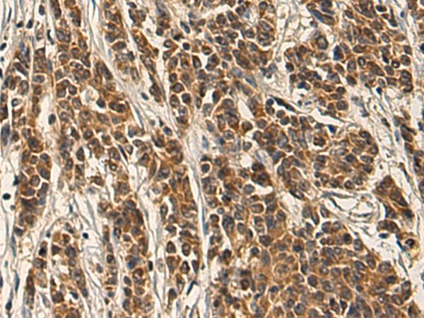 Rabbit Polyclonal Antibody to SNAP47