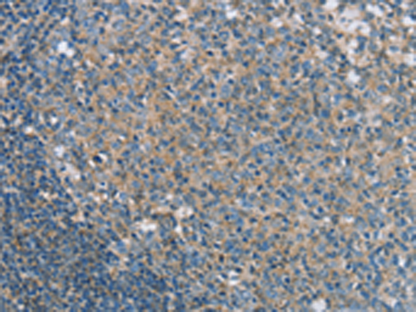 Rabbit Polyclonal Antibody to SNX15