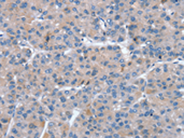 Rabbit Polyclonal Antibody to SNX27