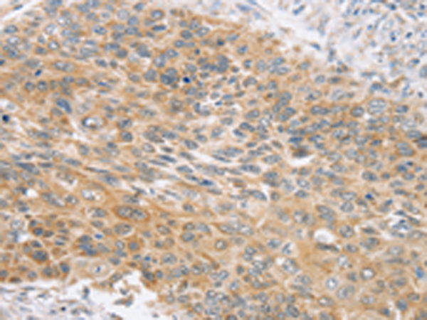 Rabbit Polyclonal Antibody to SNX4