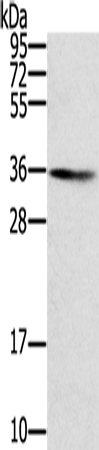Rabbit Polyclonal Antibody to SNX11