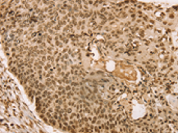 Rabbit Polyclonal Antibody to SNX8