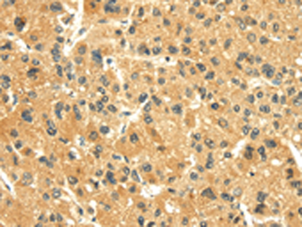 Rabbit Polyclonal Antibody to SNX20