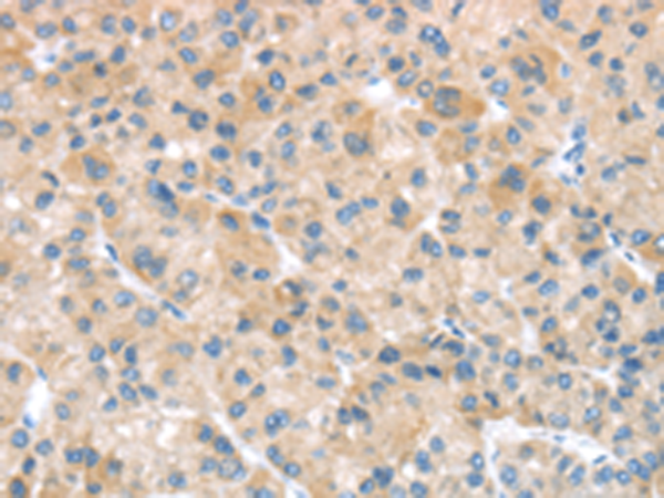 Rabbit Polyclonal Antibody to SFTPA1