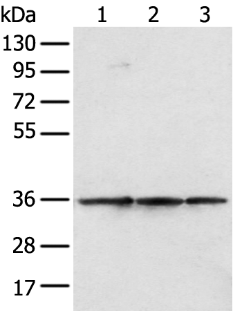Rabbit Polyclonal Antibody to SPRY4
