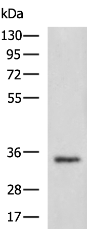 Rabbit Polyclonal Antibody to SPRY3