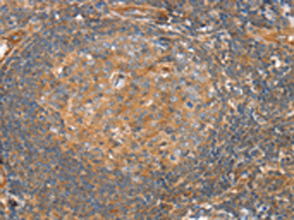 Rabbit Polyclonal Antibody to SRGAP3