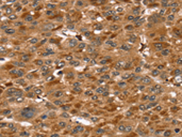 Rabbit Polyclonal Antibody to SRGN