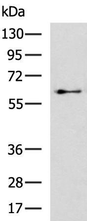 Rabbit Polyclonal Antibody to RO60