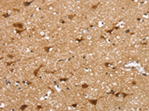 Rabbit Polyclonal Antibody to SSBP4