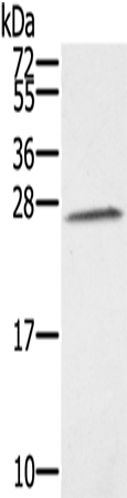 Rabbit Polyclonal Antibody to SSX1