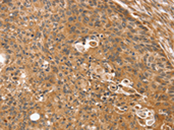 Rabbit Polyclonal Antibody to SSX2IP