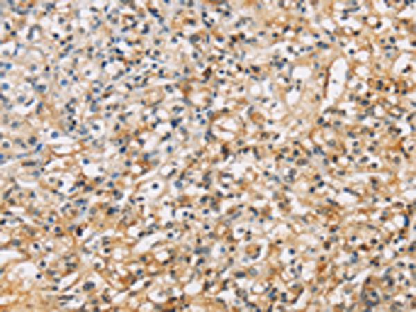 Rabbit Polyclonal Antibody to SDCBP
