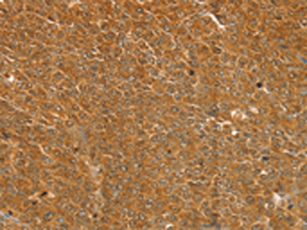 Rabbit Polyclonal Antibody to ST18