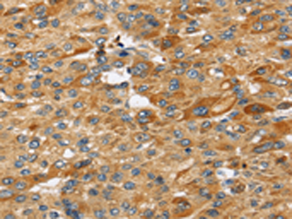Rabbit Polyclonal Antibody to STC2