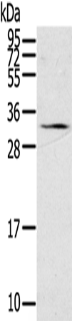 Rabbit Polyclonal Antibody to STAR