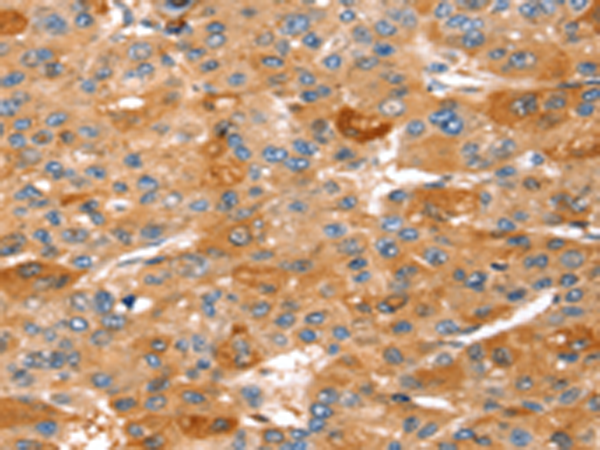 Rabbit Polyclonal Antibody to STK33