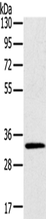 Rabbit Polyclonal Antibody to STK16
