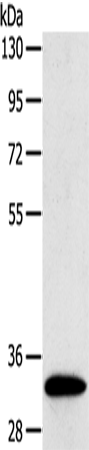 Rabbit Polyclonal Antibody to SULT1B1