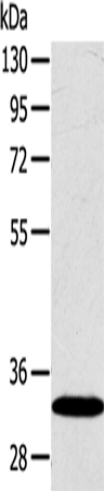 Rabbit Polyclonal Antibody to SULT2A1