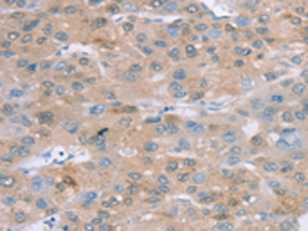 Rabbit Polyclonal Antibody to SULT2B1