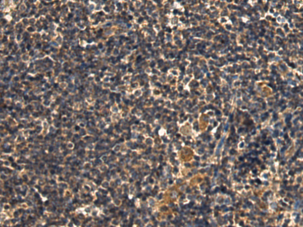 Rabbit Polyclonal Antibody to SFTPA2
