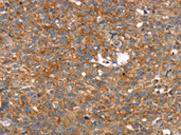 Rabbit Polyclonal Antibody to ARMC10
