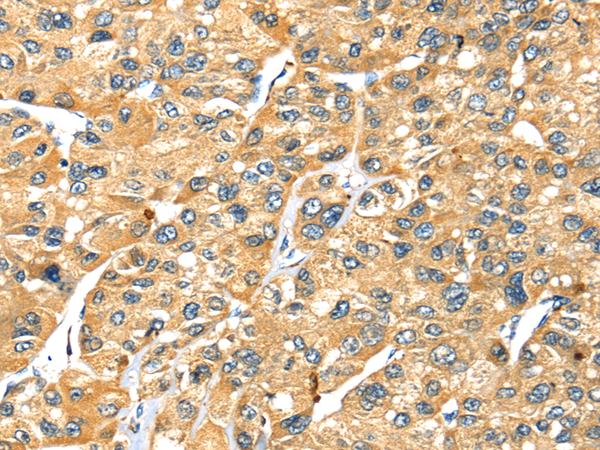 Rabbit Polyclonal Antibody to STX7