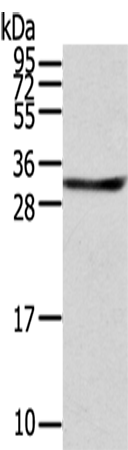 Rabbit Polyclonal Antibody to STX8