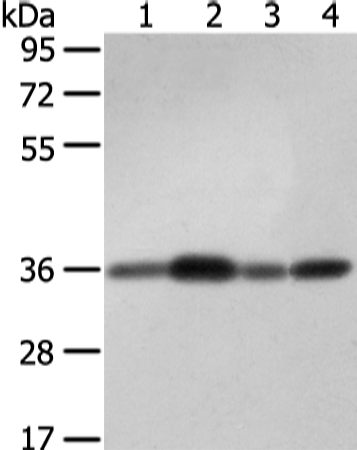 Rabbit Polyclonal Antibody to STX12