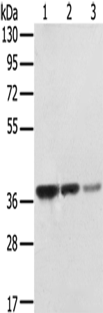 Rabbit Polyclonal Antibody to STX16