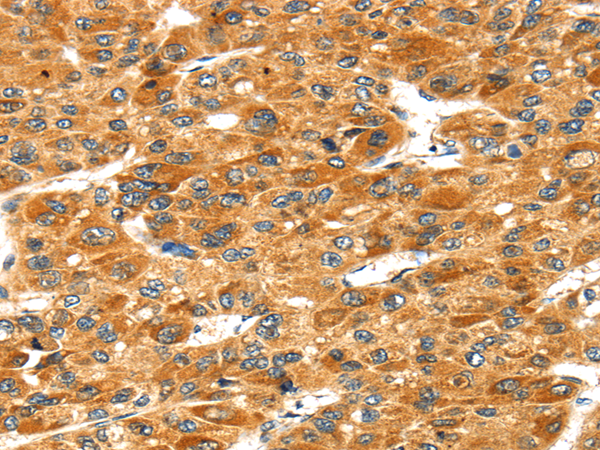 Rabbit Polyclonal Antibody to STXBP4