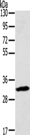 Rabbit Polyclonal Antibody to STX11