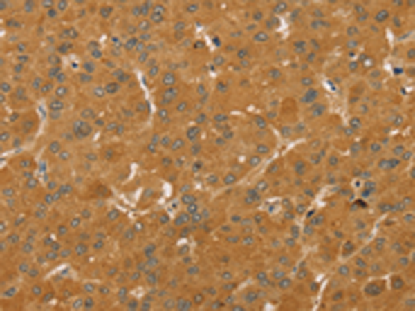 Rabbit Polyclonal Antibody to TAF11