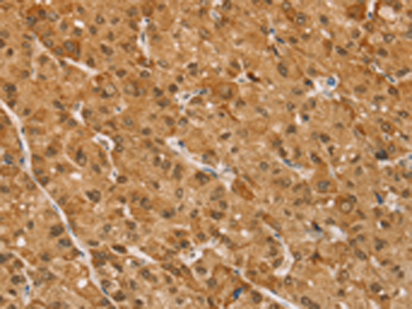 Rabbit Polyclonal Antibody to TAF12