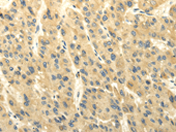 Rabbit Polyclonal Antibody to ABCB7