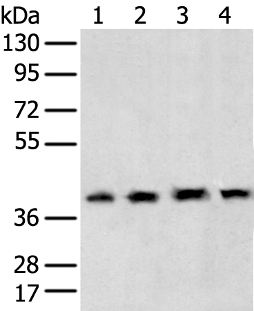 Rabbit Polyclonal Antibody to TBP