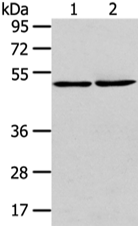 Rabbit Polyclonal Antibody to TBC1D22A