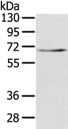 Rabbit Polyclonal Antibody to TBL1X