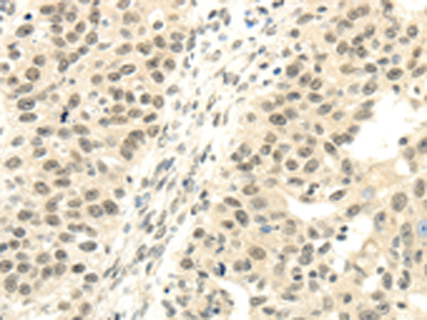 Rabbit Polyclonal Antibody to TBL1XR1