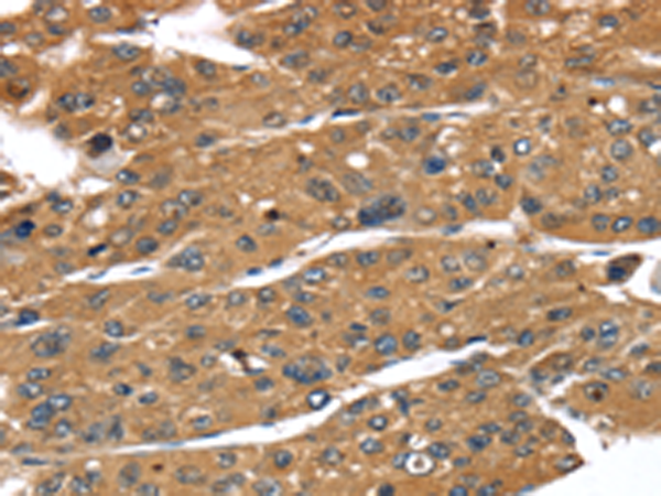 Rabbit Polyclonal Antibody to TBX10