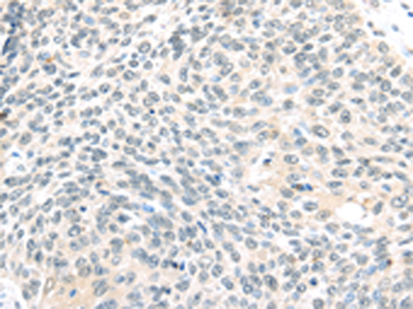 Rabbit Polyclonal Antibody to ELOC