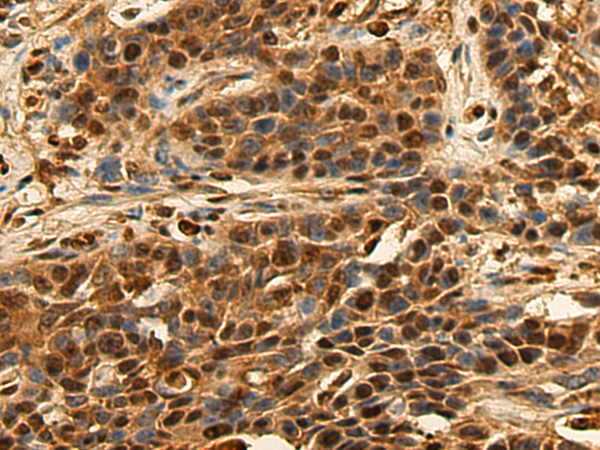 Rabbit Polyclonal Antibody to TCF3