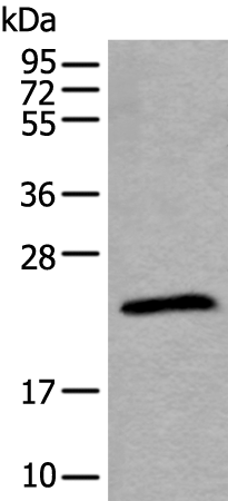 Rabbit Polyclonal Antibody to TPT1