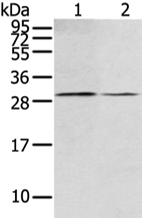 Rabbit Polyclonal Antibody to RASD2
